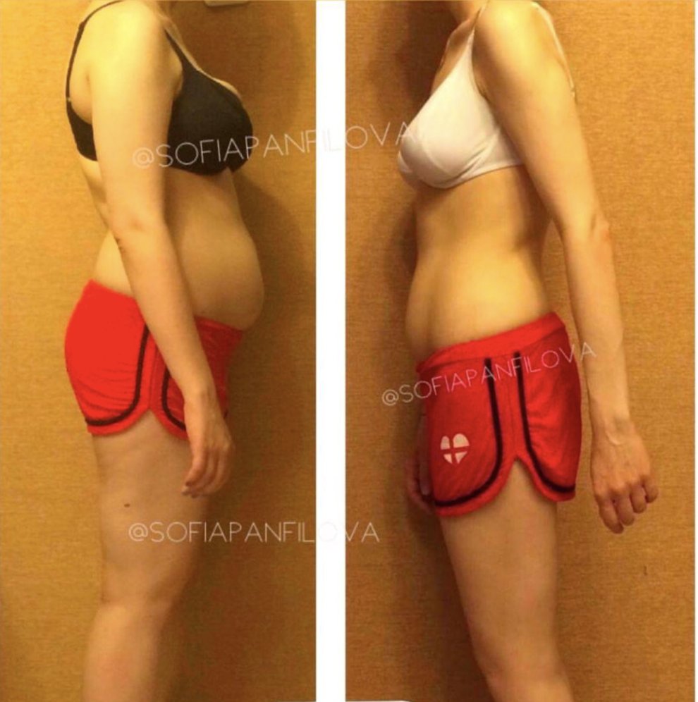 Результат клиента: изменение силуэта с персональной программой питания