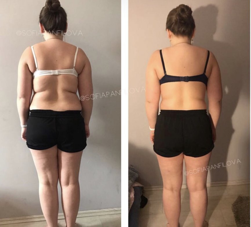 Результат клиента: трансформация спины — фото до и после программы