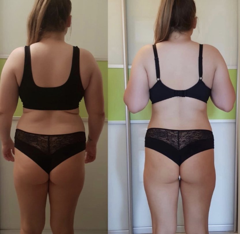 Результат клиента: коррекция фигуры и осанки — фото до и после